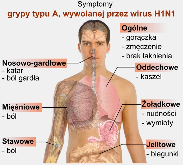 Grypa A/H1N1 symptomy objawy
